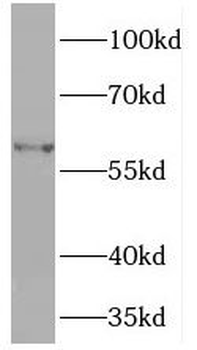 PDIA5 Rabbit Polyclonal Antibody
