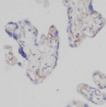 PDIA5 Rabbit Polyclonal Antibody