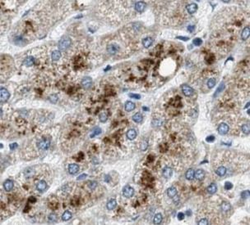 PDK1 Rabbit Polyclonal Antibody