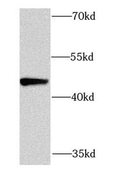 PDK3 Rabbit Polyclonal Antibody