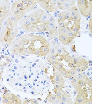 PDK3 Rabbit Polyclonal Antibody
