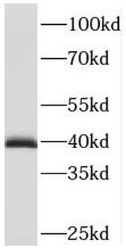 PDLIM3 Rabbit Polyclonal Antibody