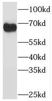 PDLIM5 Rabbit Polyclonal Antibody