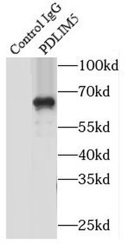 PDLIM5 Rabbit Polyclonal Antibody