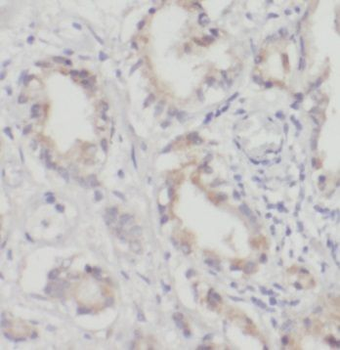 PDLIM5 Rabbit Polyclonal Antibody