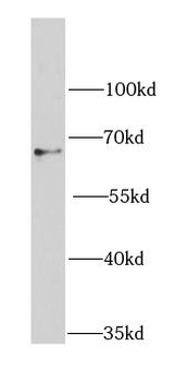 PDPK1 Rabbit Polyclonal Antibody
