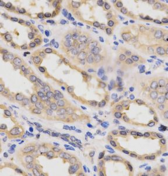 PDPK1 Rabbit Polyclonal Antibody