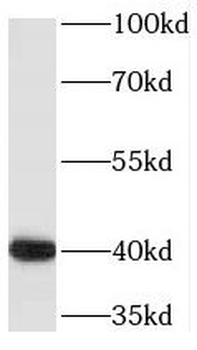 PDXK Rabbit Polyclonal Antibody