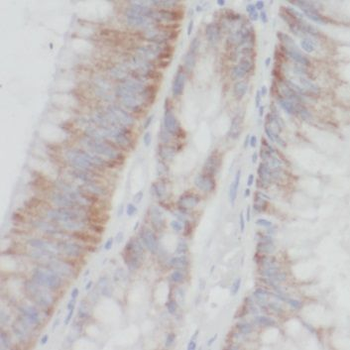PDXK Rabbit Polyclonal Antibody