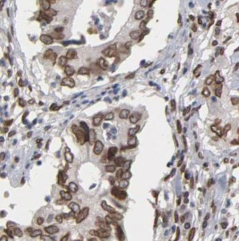 PEPD Rabbit Polyclonal Antibody