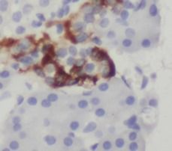 PYY Rabbit Polyclonal Antibody