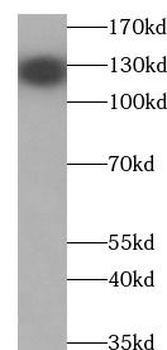 PER3 Rabbit Polyclonal Antibody