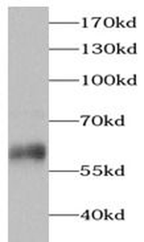 PRPH Rabbit Polyclonal Antibody