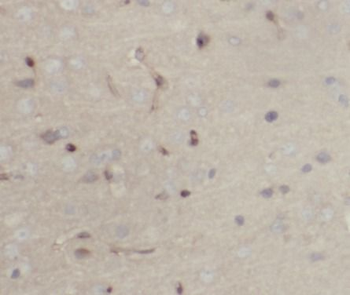PRPH Rabbit Polyclonal Antibody