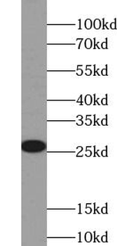 PRDX3 Antibody