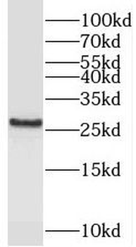 PEX11G Rabbit Polyclonal Antibody