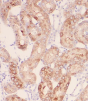 PEX11G Rabbit Polyclonal Antibody