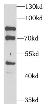 PEX5 Rabbit Polyclonal Antibody