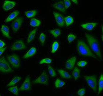 PEX5 Rabbit Polyclonal Antibody