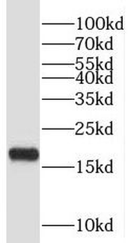 PFDN2 Rabbit Polyclonal Antibody