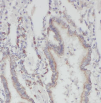 PFDN2 Rabbit Polyclonal Antibody