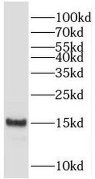 PFDN4 Rabbit Polyclonal Antibody