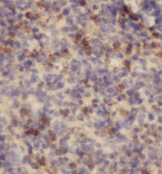 PFKFB2 Antibody