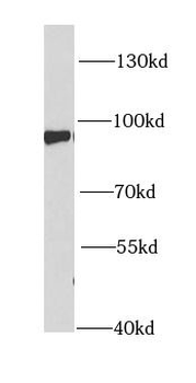 PFKM Antibody