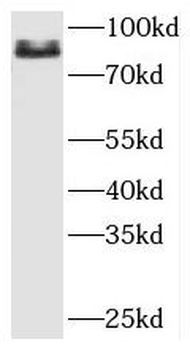 PFKP Rabbit Polyclonal Antibody