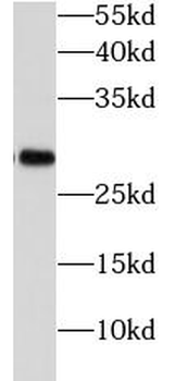 PGAM1 Antibody