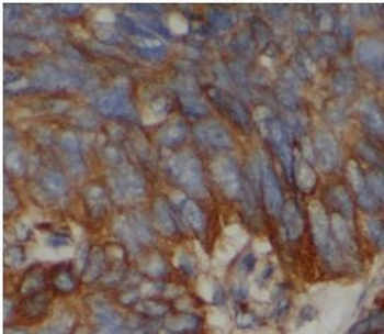 PGLYRP2 Rabbit Polyclonal Antibody