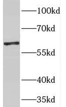 PGM1 Rabbit Polyclonal Antibody
