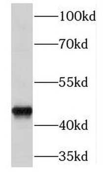 EGLN1 Rabbit Polyclonal Antibody