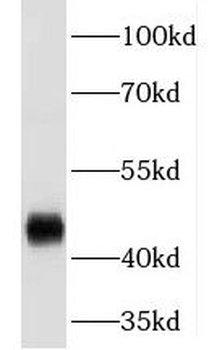 EGLN1 Rabbit Polyclonal Antibody