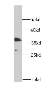 PHF11 Rabbit Polyclonal Antibody