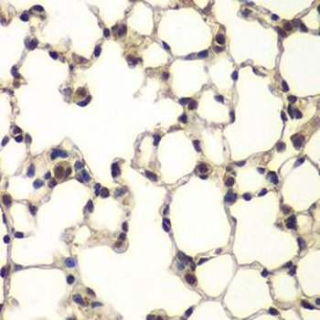 PHF11 Rabbit Polyclonal Antibody