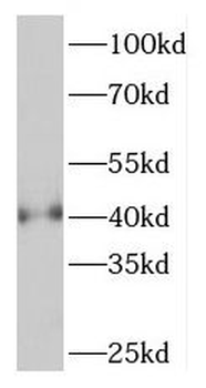 PHF6 Antibody