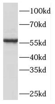 PHGDH Rabbit Polyclonal Antibody