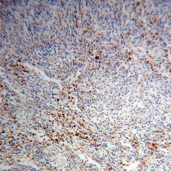 PHGDH Rabbit Polyclonal Antibody