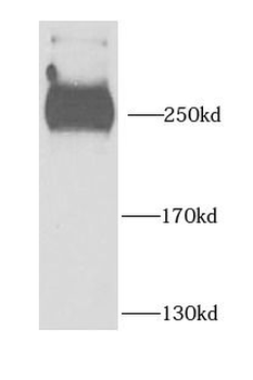PHIP Antibody