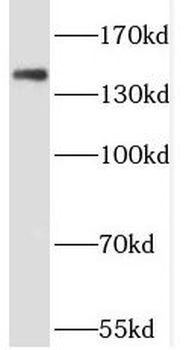 PHLPP2 Rabbit Polyclonal Antibody