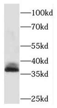 PHOX2A Rabbit Polyclonal Antibody