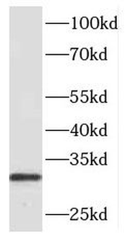 PHOX2B Rabbit Polyclonal Antibody