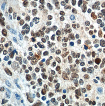 PHOX2B Rabbit Polyclonal Antibody