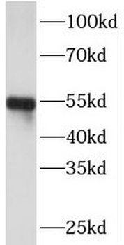 PI16 Rabbit Polyclonal Antibody