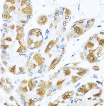 PIAS3 Rabbit Polyclonal Antibody