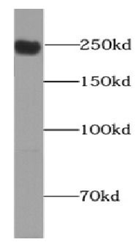 PIEZO1 Rabbit Polyclonal Antibody