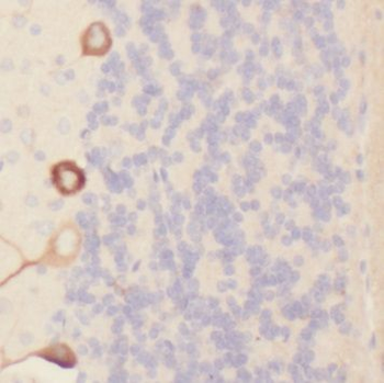 PIEZO1 Rabbit Polyclonal Antibody