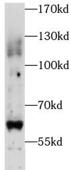 PIGZ Antibody