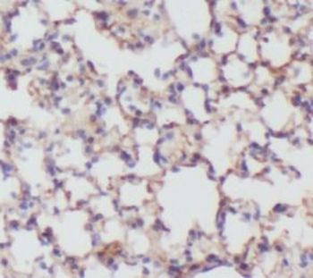 PIH1D1 Rabbit Polyclonal Antibody